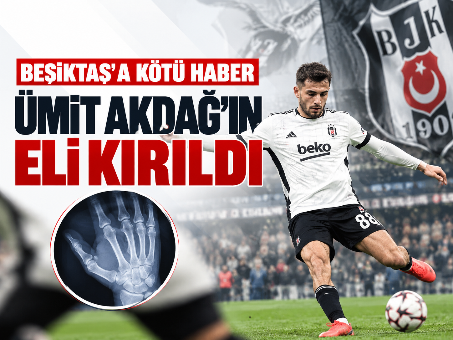 Beşiktaş’ta Ümit Akdağ’dan kötü haber
